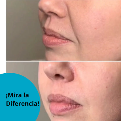Pack Parches Antiedad Frente Y Mejilla